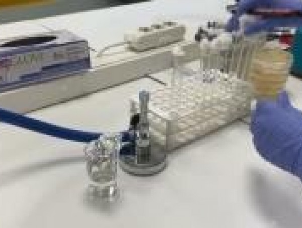 Oksidaz Test Stripleri : Mikrobiyolojide Kullanımı ve Önemi-img